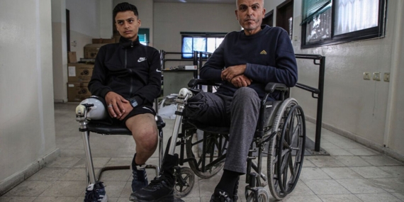 İsrail Saldırılarında Uzuvlarını Kaybeden Gazzeliler Abluka Nedeniyle Gelişmiş Protezlere Ulaşamıyor