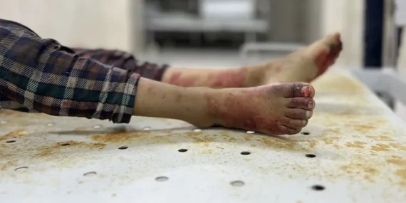 Yine Bbc, Yine Sansür: Gazze Doktorları Belgeseli Neden Yayınlanmıyor?