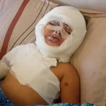 Gözlerinin ışığı söndü: Gazze'de 3 yaşındaki Misk'in yaşama tutunma mücadelesi